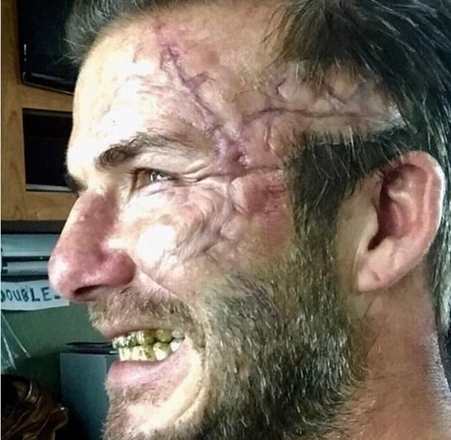 Dünyanın en yakışıklı futbolcusu ne hale geldi - Resim: 2