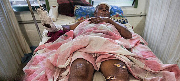 Kadınları canlı canlı yakıyorlar - Resim: 3