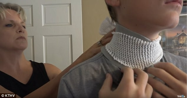 Onu arkadaşlar bir şaka uğruna bu hale getirdi sebebi ise korkunç - Resim: 1