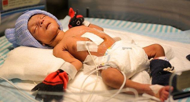 Dört ayak ve iki cinsel organla doğdu inanılmaz! - Resim: 1