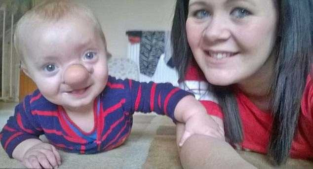 Dünya bu çocuğu konuşuyor! Pinokyo gerçek oldu... - Resim: 2