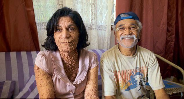 Onu gören kimse anlam veremiyor yıllardır bu halde - Resim: 2