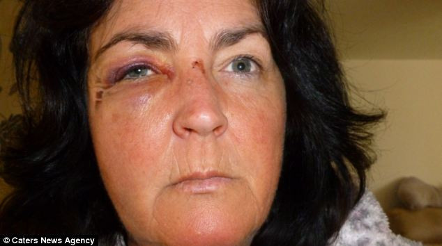 Kafasını çarptı ressam oldu - Resim: 2