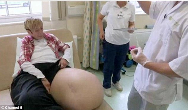 Sürekli bacakları büyüyor - Resim: 3