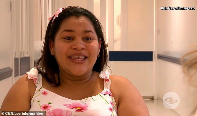 Kolombiya’da ilginç doğum bebek içinde bebek - Resim: 4