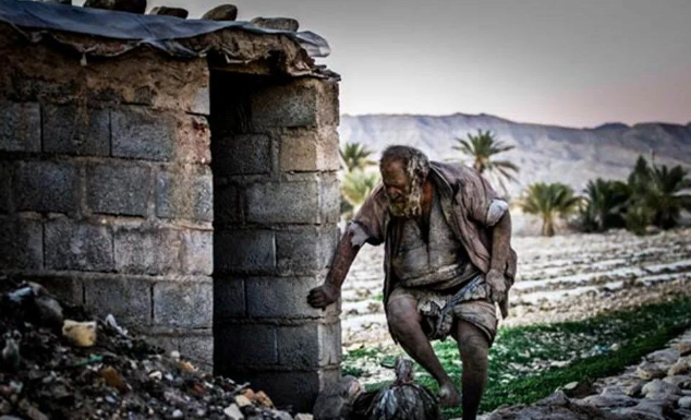 İnanılmaz olay: Dünyanın en kirli adamı temizlendi öldü! Hep korktuğu şey başına geldi - Resim: 3