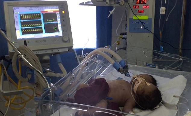 Akıllara durgunluk veren doğum 'İki baş tek benden' - Resim: 4