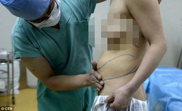 Silikonlarından birisi sırtında diğer karnında! - Resim: 4