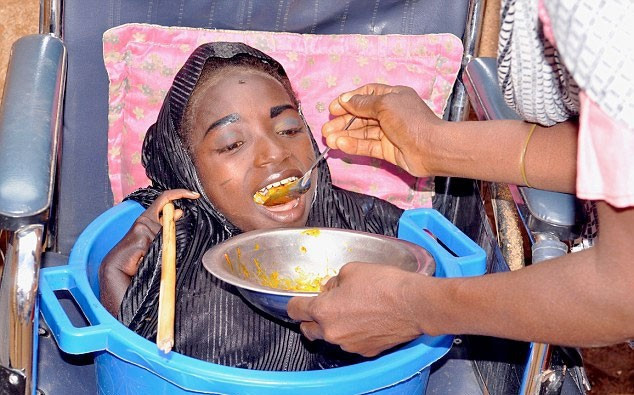 19'una kadar bedeni olmadan leğende yaşadı inanılmaz - Resim: 1