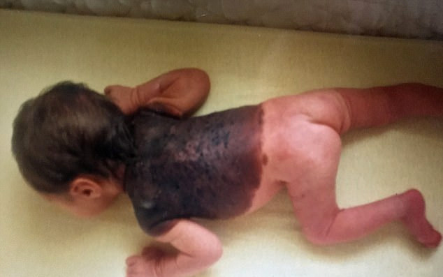 Bebek simsiyah dünyaya geldi doktorlar bile şaştı kaldı - Resim: 1