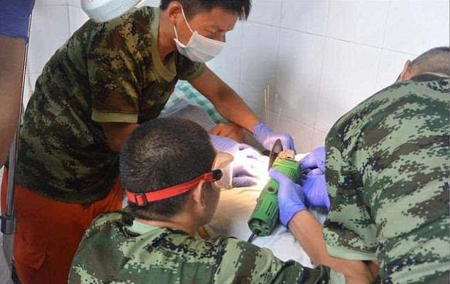 Cinsel organını yıldız anahtarına sıkıştırdı itfaiye seferber oldu - Resim: 4