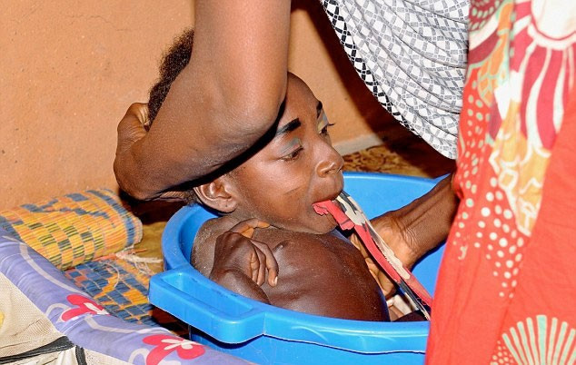 19'una kadar bedeni olmadan leğende yaşadı inanılmaz - Resim: 2