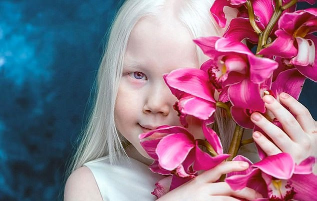 Görenleri hayrete düşüren kız gerçek 'pamuk prenses' - Resim: 4