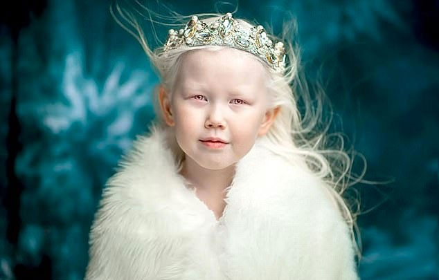 Görenleri hayrete düşüren kız gerçek 'pamuk prenses' - Resim: 1