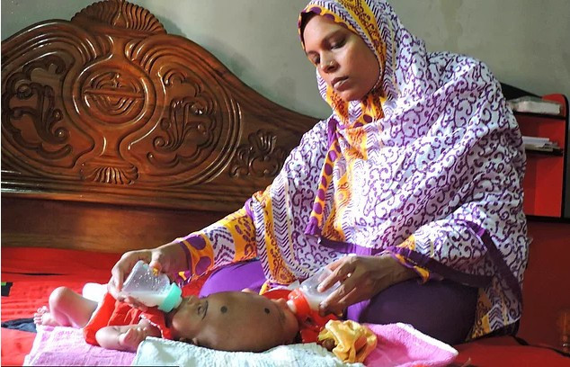 Bebekler öyle bir doğdu ki... Aile durumdan habersiz! - Resim: 1