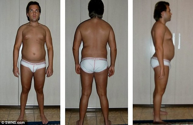 İdeal erkek olabilmek için 1 milyon TL harcadı işte sonuç.. - Resim: 2