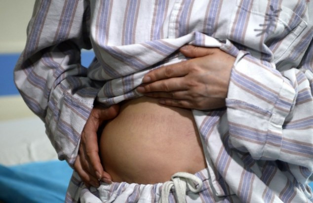 Silikonlarından birisi sırtında diğer karnında! - Resim: 1