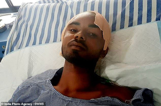 İşçinin başına demir saplandı! Doktorlar onu sağ görünce şaşırdı - Resim: 4