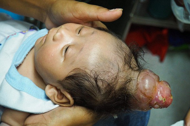 El kadar bebek böyle doğdu tıp dünyası hayrete düştü! - Resim: 1