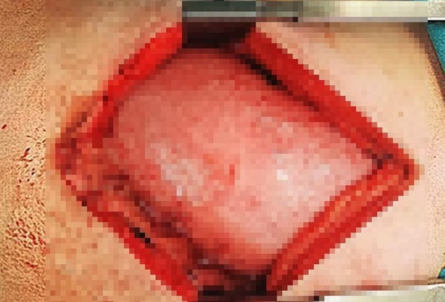 Karnından çıkanlar şok etti - Resim: 2