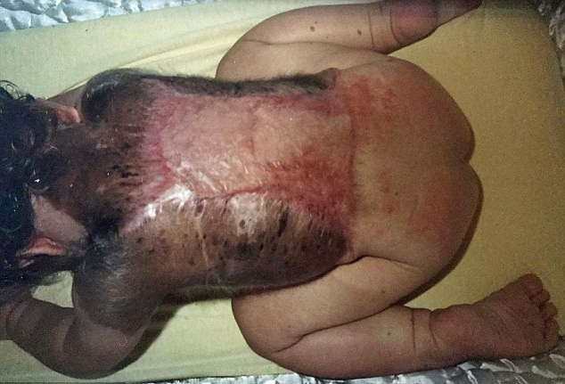 Bebek simsiyah dünyaya geldi doktorlar bile şaştı kaldı - Resim: 3