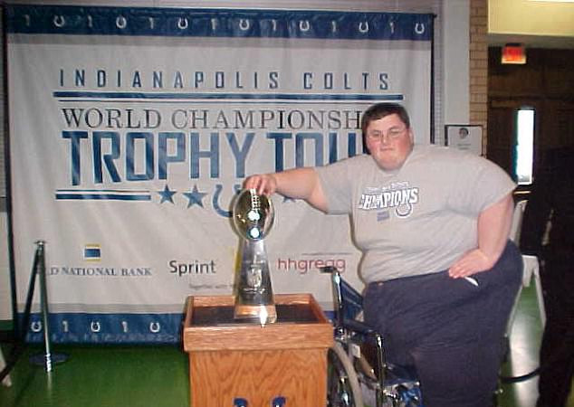 Tam 308 kiloydu ve bir bacağı yoktu değişimi ise inanılmaz - Resim: 4