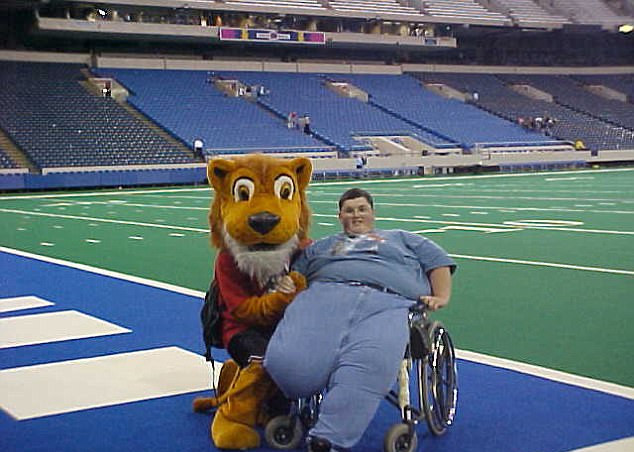 Tam 308 kiloydu ve bir bacağı yoktu değişimi ise inanılmaz - Resim: 3