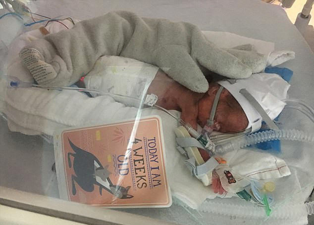 Dünya onu konuştu 'Uzaylı bebek' görenleri şoke ediyor - Resim: 1