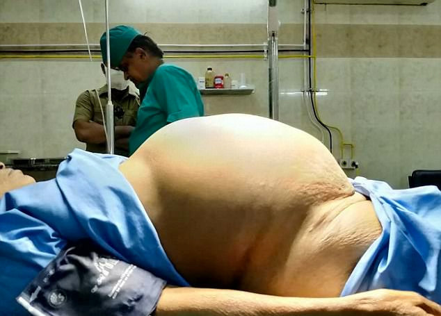 Herkes onu hamile sandı ama karnından öyle bir şey çıktı ki - Resim: 1