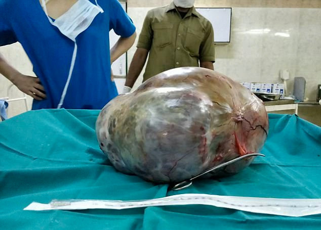 Herkes onu hamile sandı ama karnından öyle bir şey çıktı ki - Resim: 4