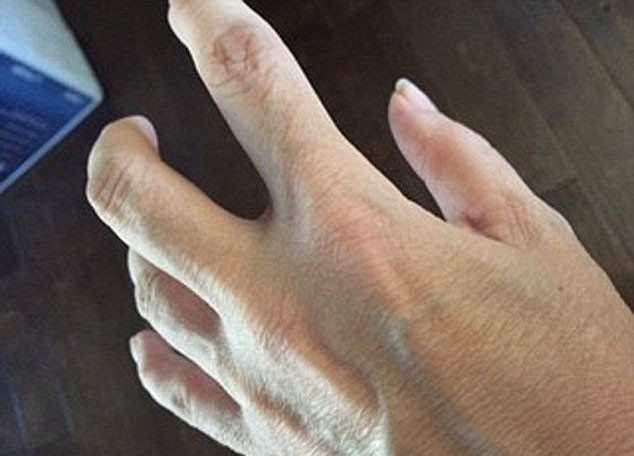 Vücudu taşlaşıyor heykele dönüşüyor inanılmaz! - Resim: 3