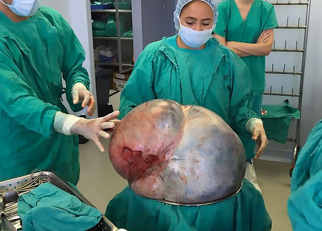 Karnı her geçen gün büyüdü ve bu hale geldi sonra da... - Resim: 4