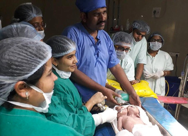 Akıllara durgunluk veren doğum 'İki baş tek benden' - Resim: 2