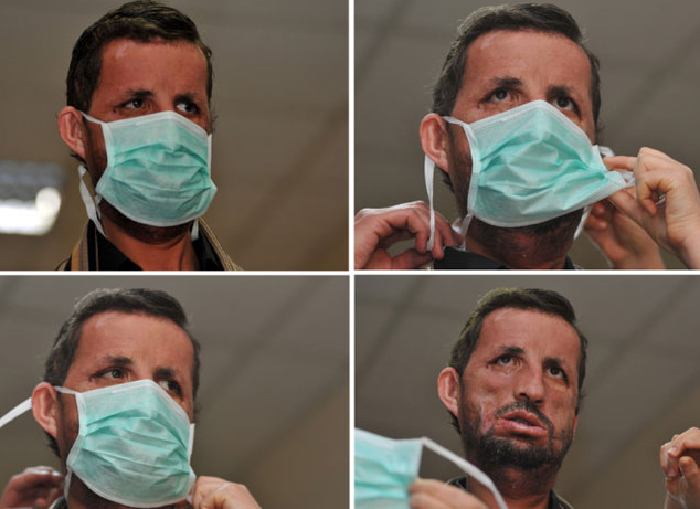 Yüzünü bu kadar yakından gördünüz mü? - Resim: 1