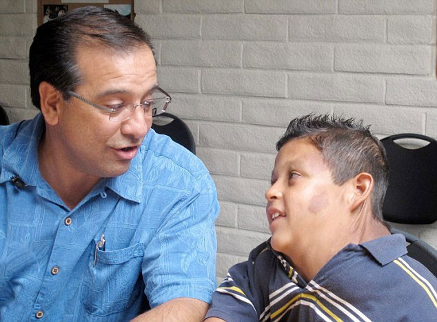 Dev tümör çocuğu bu hale getirdi - Resim: 2