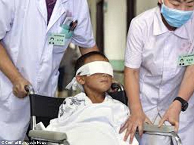 5 yaşındaki oğlunun gözlerini oydu - Resim: 1