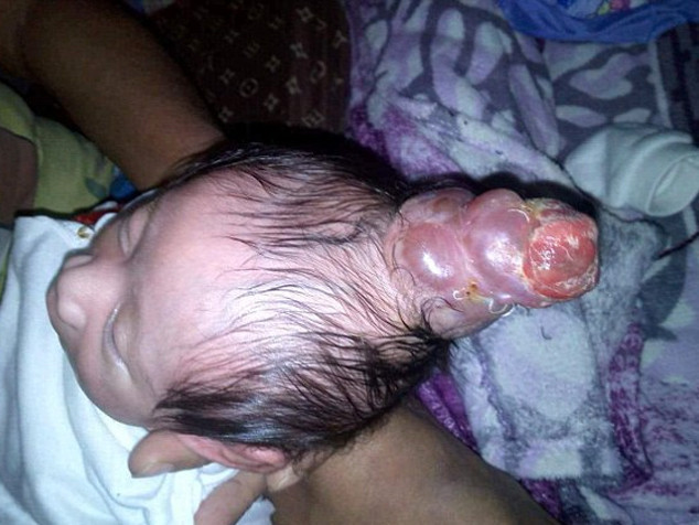 El kadar bebek böyle doğdu tıp dünyası hayrete düştü! - Resim: 4