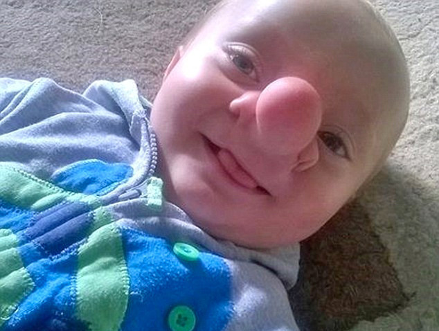 Bebeği bu halde dünyaya geldi görenler gözlerine inanamadı 3 yıl sonra... - Resim: 4