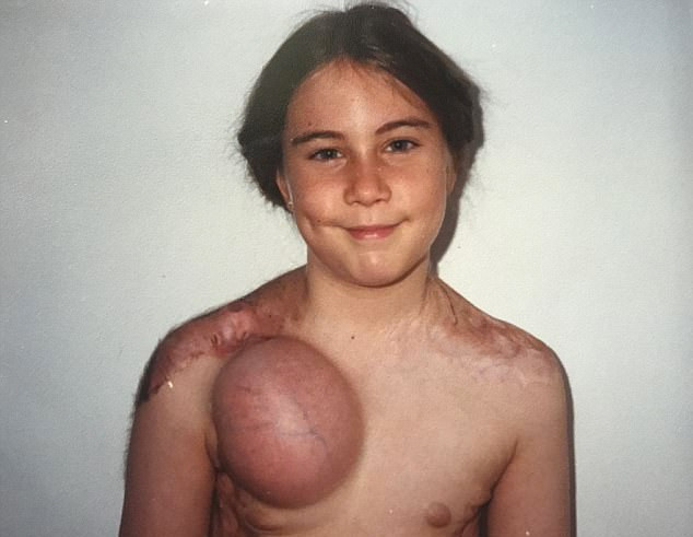 Bebek simsiyah dünyaya geldi doktorlar bile şaştı kaldı - Resim: 4