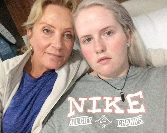 Diş fırçalarken yüz felci geçirdi! - Resim: 2