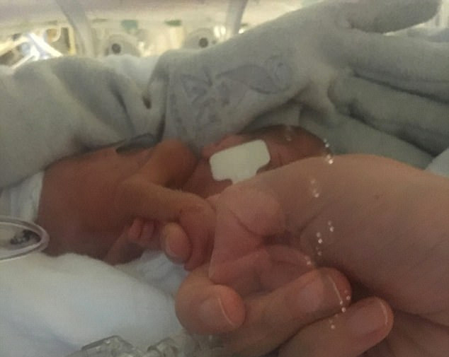 Dünya onu konuştu 'Uzaylı bebek' görenleri şoke ediyor - Resim: 4