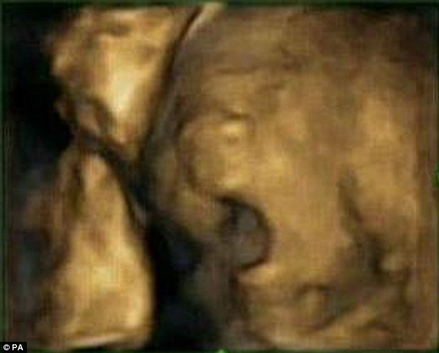 Anne karnındaki bebeğin esneme anları - Resim: 2