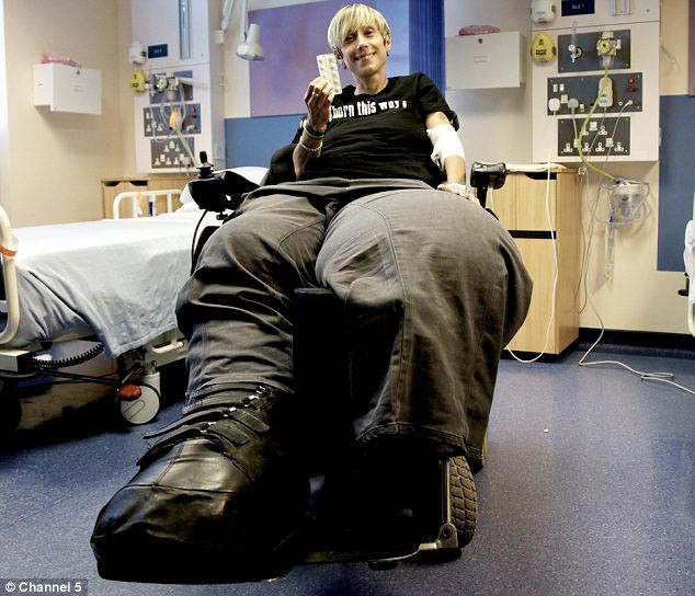 Sürekli bacakları büyüyor - Resim: 2