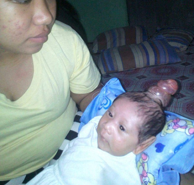 El kadar bebek böyle doğdu tıp dünyası hayrete düştü! - Resim: 2