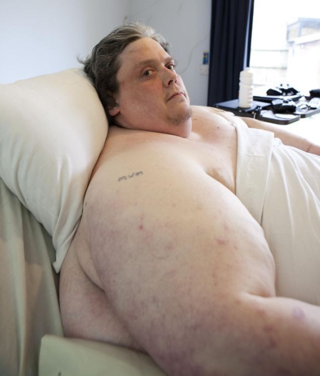 30 yaşına kadar yaşamazsın denilince...  - Resim: 2