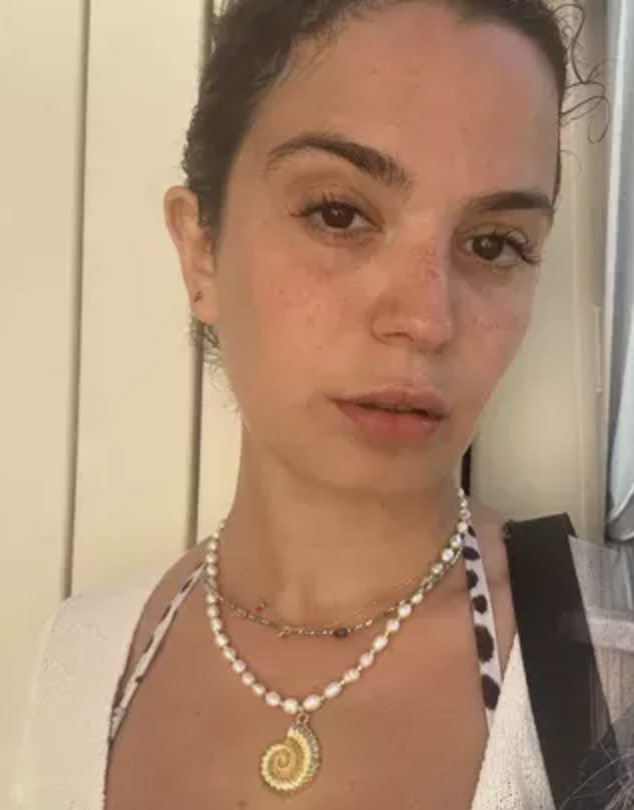 Gözyaşları içinde anlattı! Aslı Bekiroğlu'nun doktorları da ne yapacaklarını bilemiyor - Resim: 3