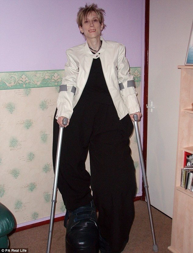 Dünyada bu hastalık sadece onda var - Resim: 4