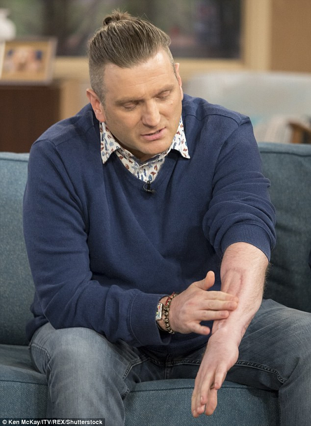 Penissiz doğdu, 44 yıl sonra ilk kez seks yapacak - Resim: 3