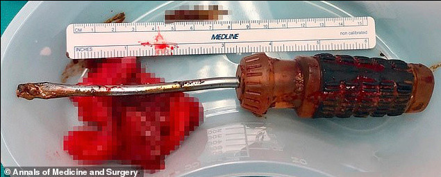 Anüsüne sokunca bir anda içeri kaçtı 1 hafta sonra da... - Resim: 0