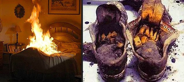 Kendi kendine yanarak öldü! Bilimin açıklayamadığı esrar - Resim: 1